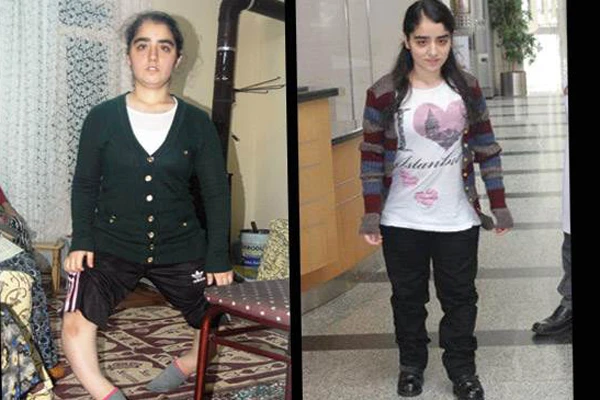 Seher 18 yıl sonra bacaklarına kavuştu