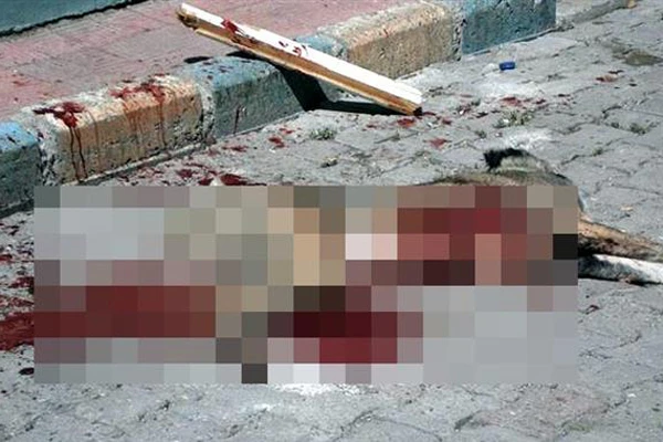 Erzurum'da 6 kişiyi ısıran köpeği bıçakla öldürdüler