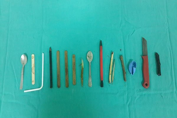 15 yaşındaki çocuğun midesinden bakın neler çıktı