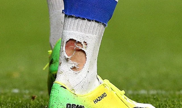 Hazard, Chedjou'ya bu fotoğraflarla cevap verdi