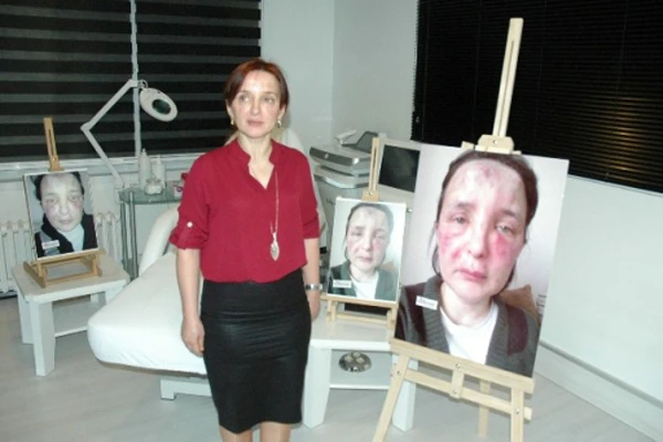 Sahte doktor kurbanı kadının yüzünde şaşırtan değişim