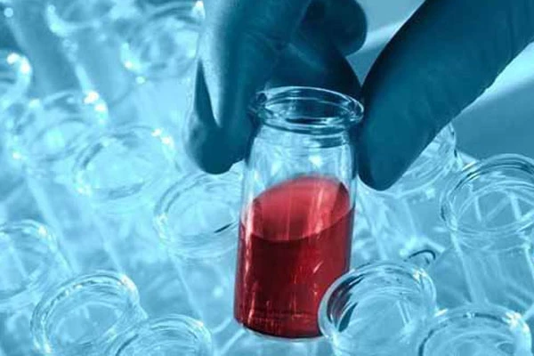 Sepsis hastalığı nedir kimlerde görülür, tedavi ve belirtileri nelerdir