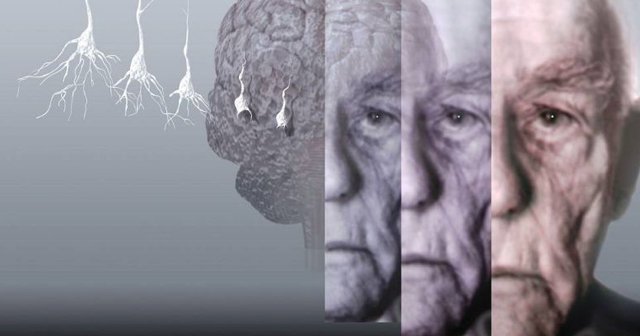 Alzheimer&#039;a ilaçsız tedavi geliştirildi