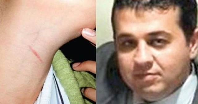 Öğrencisinin boğazını maket bıçağı ile kesti