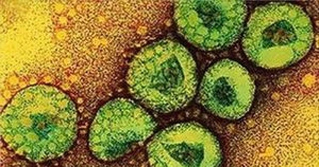 MERS salgınında bilanço ağırlaşıyor, 27 ölü