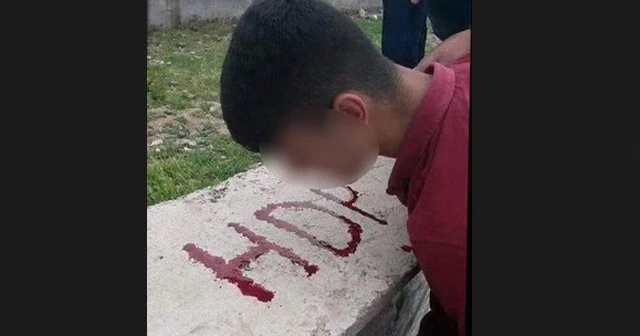 Dövdükleri çocuğun kanıyla HDP yazdılar