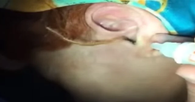 Kulağından kırkayak çıktı