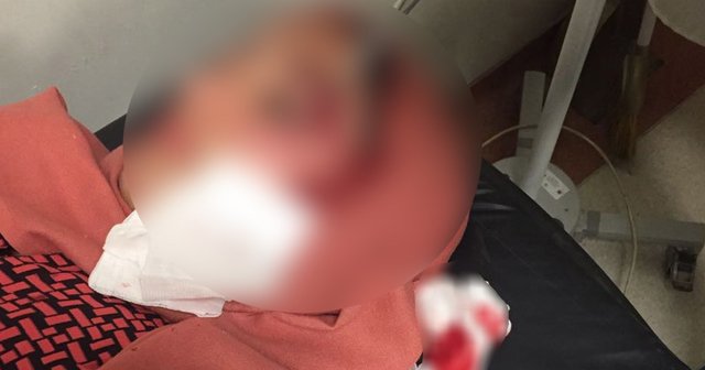 AK Parti’li kadınlara taşlı saldırı: 2 yaralı