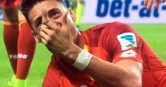 Parmağı ortadan ikiye kırıldı