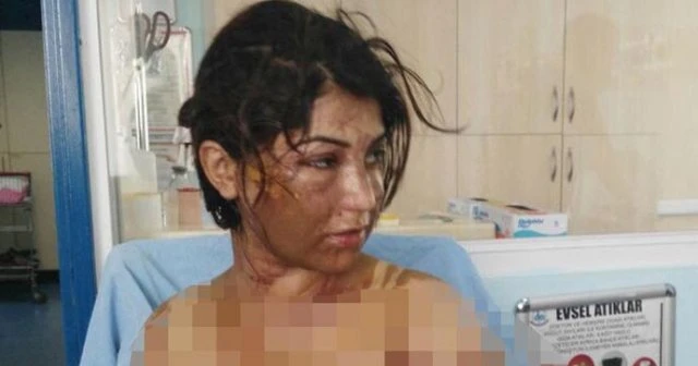 Uyuyan hala ve yeğene asitli saldırı