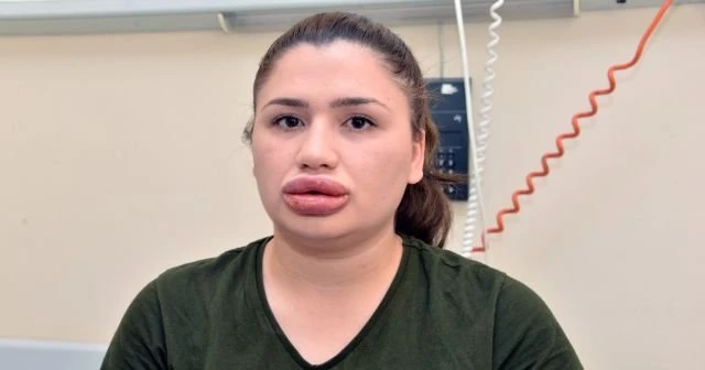 Silikon mağduru hemşirenin son hali