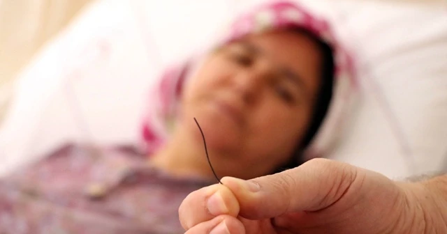 Petek bal yedi, midesinden 10 santim tel çıktı