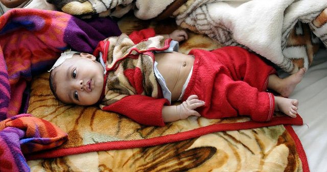 UNICEF: Yemen&#039;de 10 milyon çocuk acil yardıma muhtaç