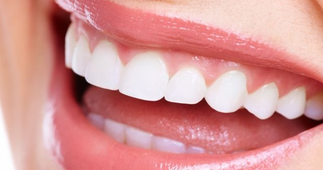 Diş beyazlatma tedavisinde bilinmesi gerekenler