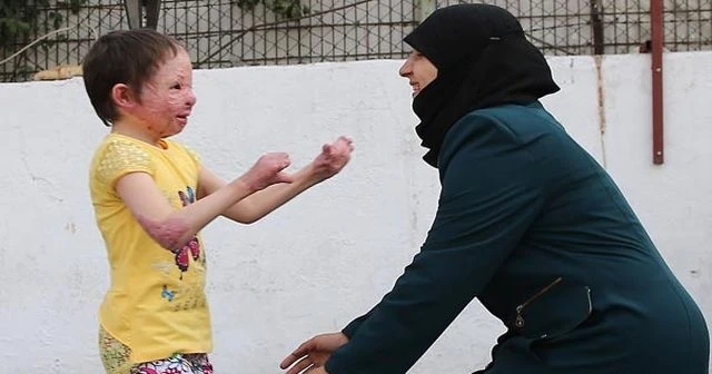 İdlibli Hiba ailesine kavuştu