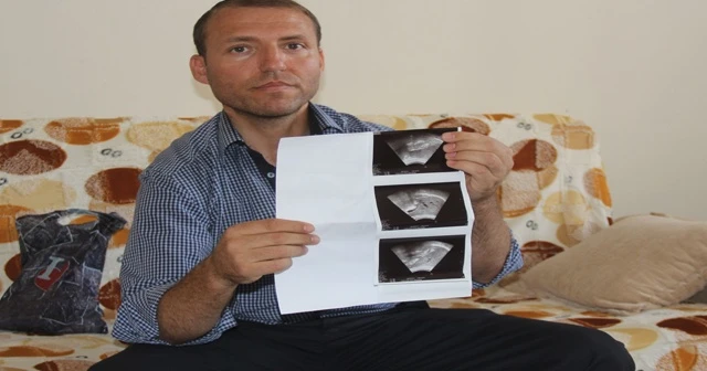 Önce babasını, ardından babasından nakil aldığı böbreğini kaybetti