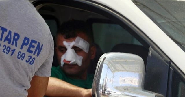 Bayramın ilk günü 3 bin 102 acemi kasap hastanelik oldu