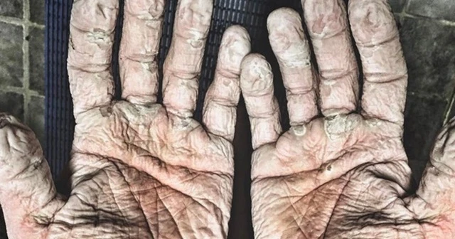 Dünya rekoru kıran Alex Gregory'nin paylaştığı fotoğraf olay oldu