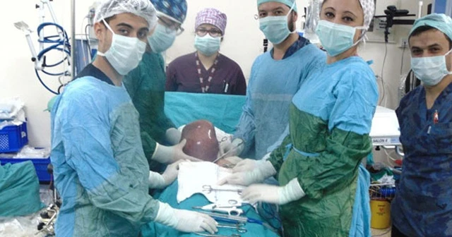 Karın ağrısı şikayetiyle gitti, rahminden 5 kilo ur çıktı