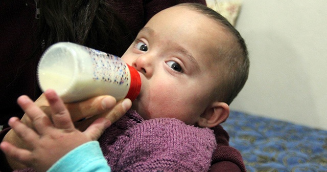 Hayata tutunan Eymen bebek yaşamak için yardım eli bekliyor