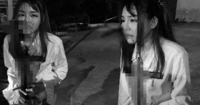 Kapkaççı kendisine direnen genç kadını yüzünden bıçakladı