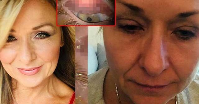 25 yıl boyunca gözündeki rimeli temizlemedi, doktorlar şok oldu