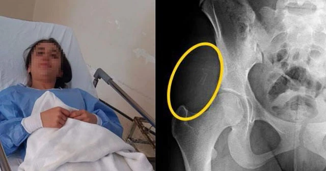 Genç kızın MR'ına bakan doktor şoke oldu!