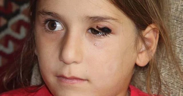 Temas edenlerin vücudunda yaralar çıktı