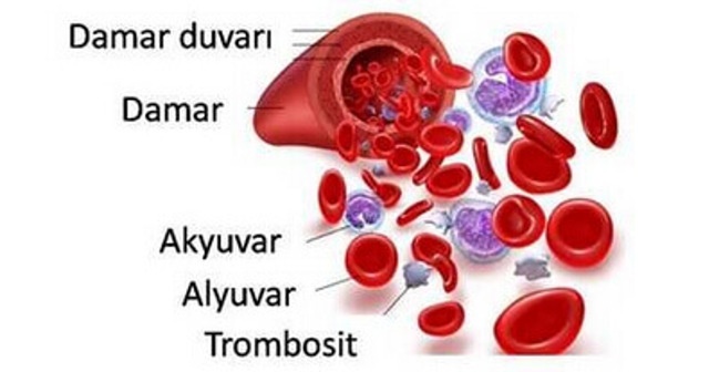 PLT Nedir? PLT Trombosit Yüksekliği Belirtileri Sebepleri ve Tedavisi