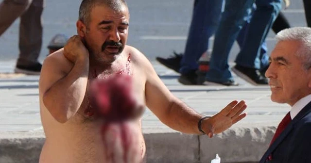 Valilik önünde kendini doğradı!