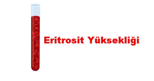 Eritrosit yüksekliği neden olur? Nasıl düşer