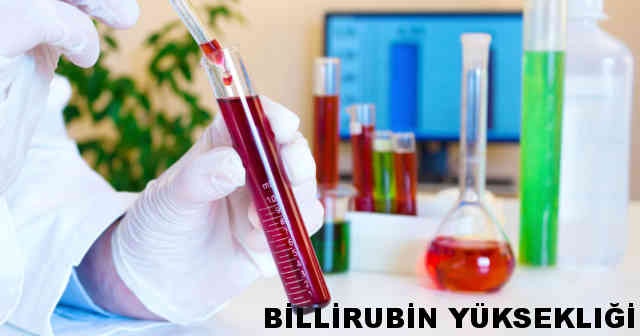 Bilirubin Nedir, Bilirubin Seviyesinin Yüksek Olmasının Belirtileri Nedenleri