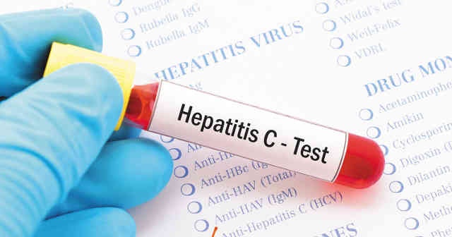 Hepatit C Nedir Nasıl Bulaşır Hepatit C Belirtileri Tedavisi Var Mı?