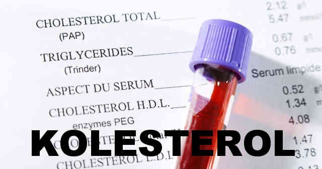 Kolesterol nedir? Yüksek Kolesterol Belirtileri Nelerdir Nasıl Tedavi Edilir
