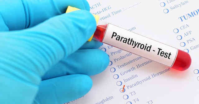 Parathormon nedir ne işe yarar görevi nedir, Parathormon kan testi