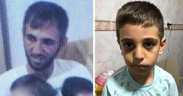 Cani babanın korkunç ifadesi: Merdivenden düştü dedim