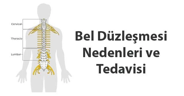 Belde Düzleşme ve Kireçlenme Bel Omurilik Düzleşmesi Fizik Tedavi Hareketleri