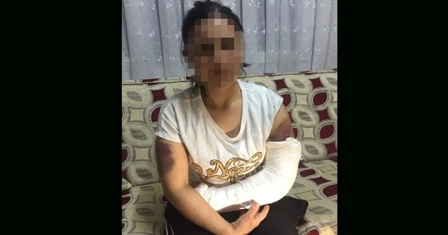 Kocası inşaat demiriyle döverek bu hale getirdi
