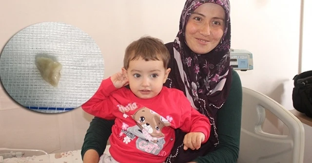 Minik Elif&#039;in akciğerini tıkayan fıstık, 1 ay sonra çıkarıldı