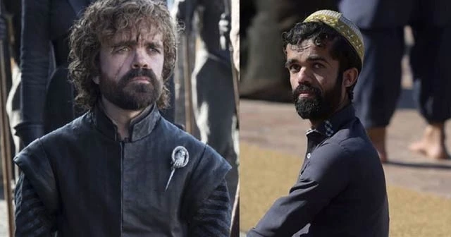 Tyrion Lannister'e benzerliğiyle dikkat çekti!