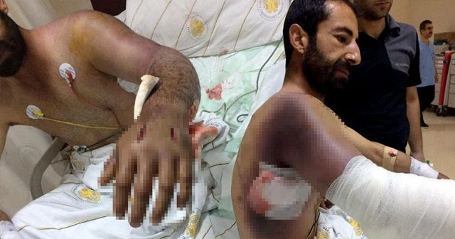 Diyarbakır'da korkunç olay! Yılan bu hale getirdi