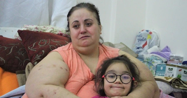 220 kiloluk kadının 'beni kurtarın' feryadı
