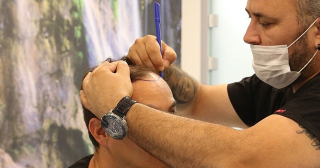 DoctorZen Medikal Direktörü Zengin, saç ekiminde ‘Fiber Fue&#039; yöntemini anlattı