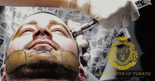 Hair Center of Turkey&#039;de ağrısız ve tıraşsız saç ekimi ayrıcalıklarını yaşayın