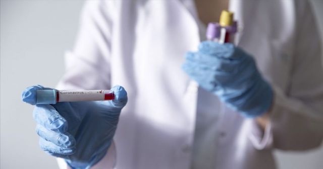 Azerbaycan&#039;da 2 kişide daha yeni tip koronavirüs tespit edildi