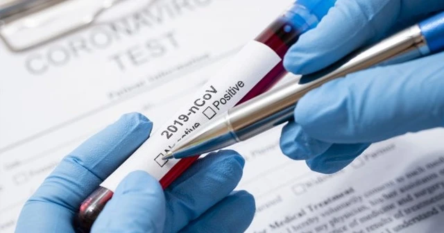 Covid-19 testleri yarından itibaren Kayseri Şehir Hastanesi'nde yapılmaya başlanacak