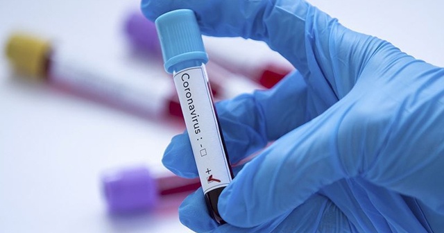 Dünya genelinde yeni tip koronavirüs bulaşan kişi sayısı 97 bini aştı