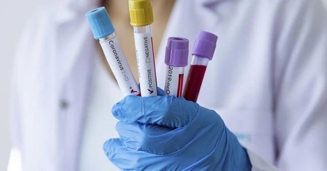 Gabon'da ilk koronavirüs vakası görüldü