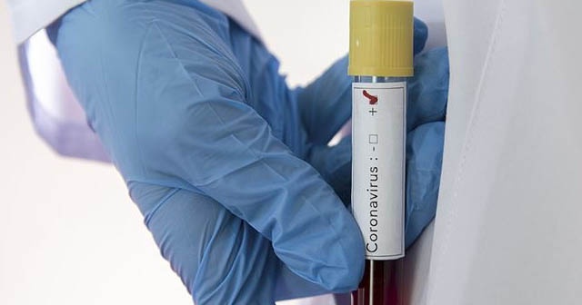 Japonya’dan koronavirüsüne karşı umut olacak çalışma