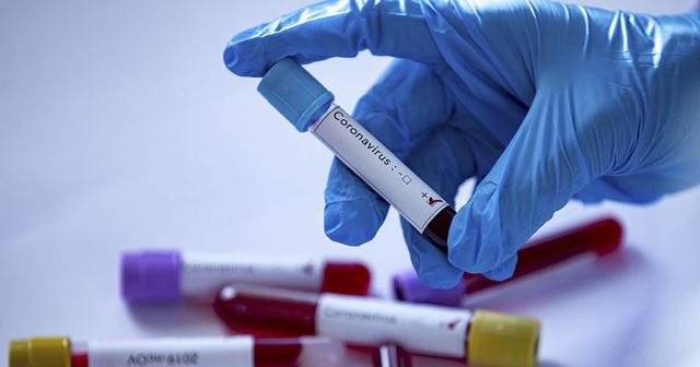 Libya&#039;da ilk koronavirüs vakası tespit edildi